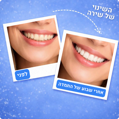 62 טבליות לניקוי עמוק ורענון הנשימה – FreshyTabs