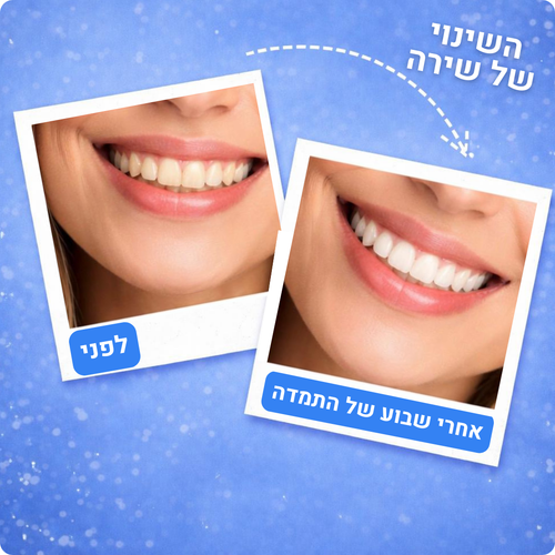 62 טבליות לניקוי עמוק ורענון הנשימה – FreshyTabs