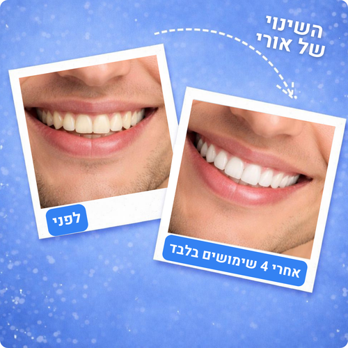 62 טבליות לניקוי עמוק ורענון הנשימה – FreshyTabs