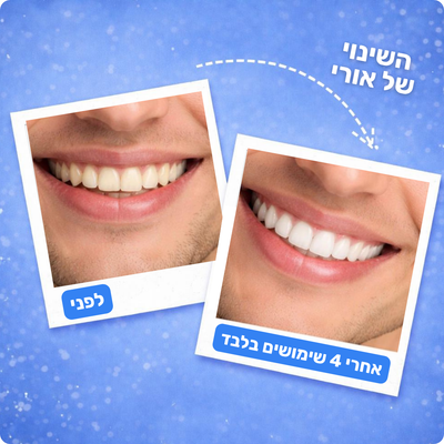 מארז ההלבנה מבית-™Freshy