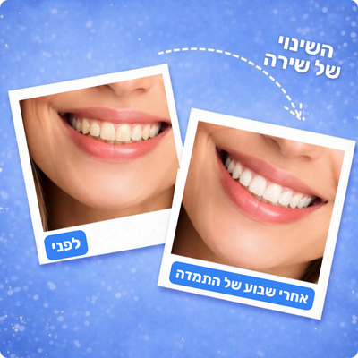 מארז ההלבנה מבית-™Freshy