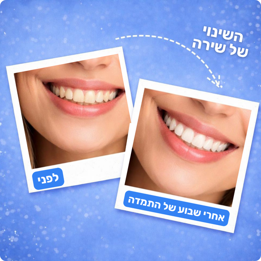מארז ההלבנה מבית-™Freshy