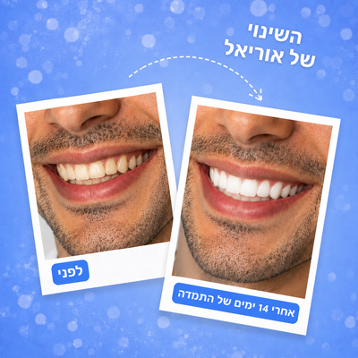 מארז ההלבנה מבית-™Freshy