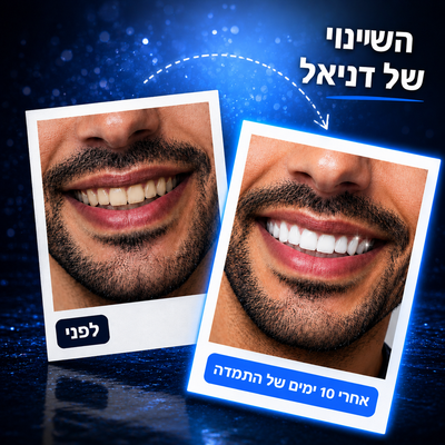 62 טבליות לניקוי עמוק ורענון הנשימה – FreshyTabs